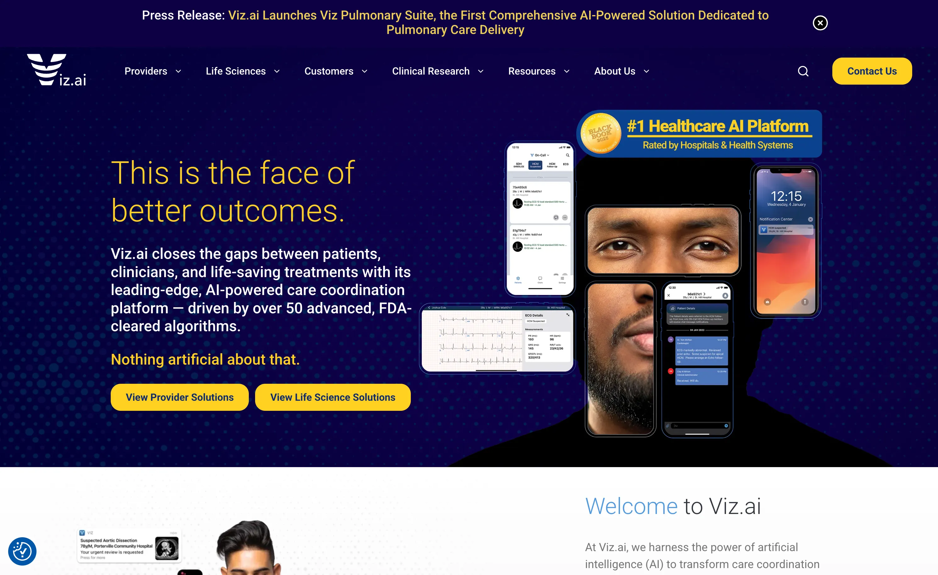 Viz.ai AI-powered care coordination platform for stroke and critical care